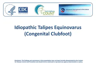Idiopathic Talipes Equinovarus (Clubfoot) and its Characteristics