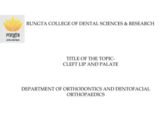 Cleft Lip and Palate: Research Insights and Management Strategies