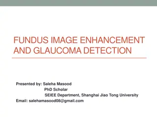 Fundus Image Enhancement and Glaucoma Detection