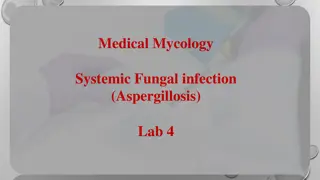 Aspergillosis: Symptoms, Types, and Treatment