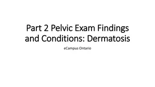 Vulvovaginal Dermatosis and Genitourinary Syndrome of Menopause