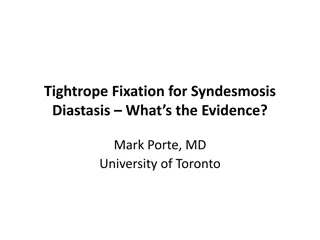 Tightrope Fixation for Syndesmosis Diastasis: What's the Evidence?