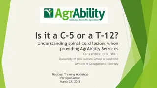 Spinal Cord Injuries Overview