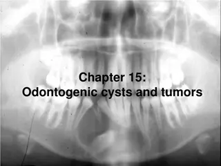 Odontogenic Cysts and Tumors