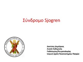 Overview of Sjogren Syndrome and Related Conditions