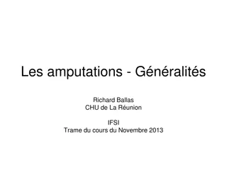 Amputations: General Overview and Procedures