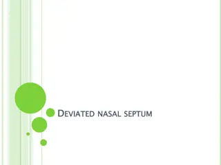 Understand Deviated Nasal Septum Disorder
