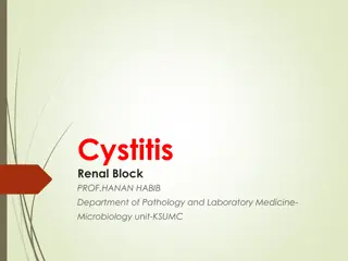 Understanding Cystitis: Causes, Symptoms, and Treatment Options