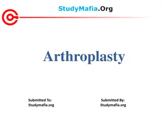Understanding Arthroplasty: Joint Replacement Surgery Explained