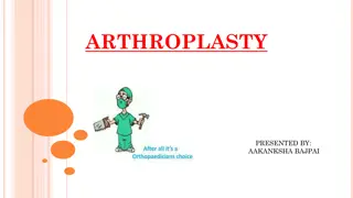 Understanding Arthroplasty: Joint Replacement Surgery Explained