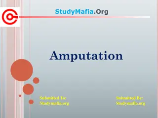 Understanding Amputation: Causes, Types, and Recovery Process