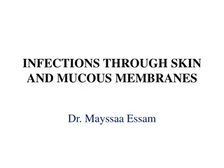 Understanding Infections Through Skin and Mucous Membranes