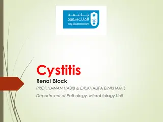 Understanding Cystitis: Causes, Symptoms, and Treatment Options