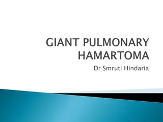 Hamartomas: A Case Study in Thoracic Medicine