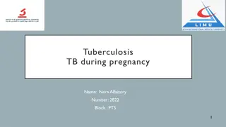 Effects of Tuberculosis on Pregnant Women and Fetus: Diagnosis and Management