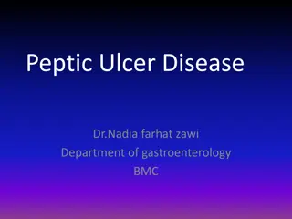Understanding Peptic Ulcer Disease and Its Clinical Features