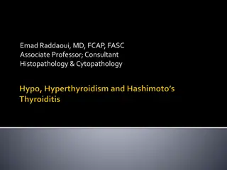 Understanding Thyroid Disorders: Causes, Manifestations, and Classification