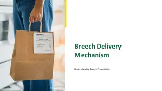 Understanding Breech Delivery: Types, Risks, and Complications