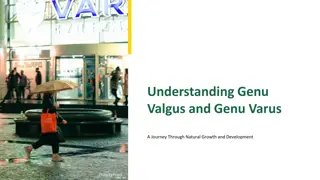 A Journey Through Genu Valgus and Genu Varus: Understanding Natural Growth