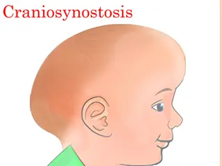 Understanding Craniosynostosis: Causes, Symptoms, and Treatment
