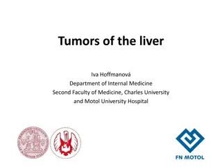Liver Tumors: Types, Surveillance, and Treatment Strategies
