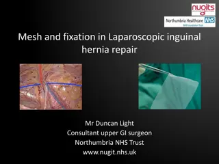 Laparoscopic Inguinal Hernia Repair: Mesh and Fixation Overview