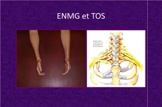 Neurophysiological Diagnosis of Thoracic Outlet Syndrome: A Comprehensive Study