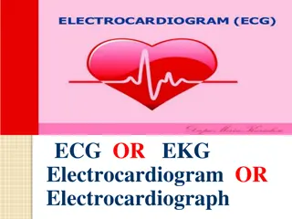 Understanding Electrocardiograms: Leads, Waves, and Interpretation