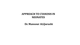 Approach to Cyanosis in Neonates: Steps for Diagnosis and Management