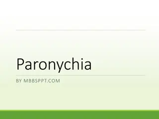 Understand Paronychia: Nail Infection Types & Treatment Guide