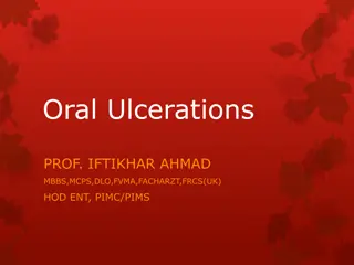 Understanding Oral Ulcerations: Causes, Types, and Treatments