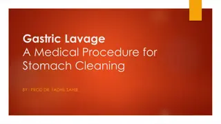 Understanding Gastric Lavage: Procedure, Uses, and Steps