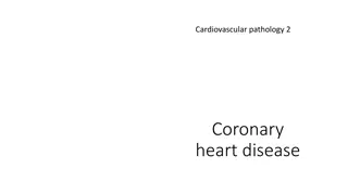 Understanding Ischemic Heart Disease and Its Impact on Cardiovascular Health