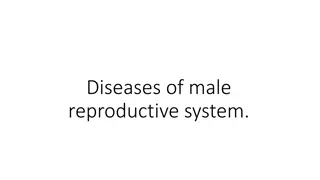 Understanding Prostate Disorders and Clinical Symptoms