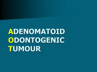 Adenomatoid Odontogenic Tumour: Clinical Features, Radiological Findings, and Differential Diagnosis