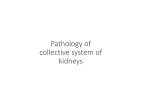 Understanding Urinary Tract Obstruction and Urolithiasis