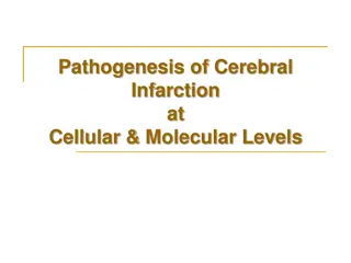 Understanding Cerebral Infarction at Cellular and Molecular Levels