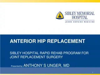 Anterior Hip Replacement and Joint Health Seminar at Sibley Hospital