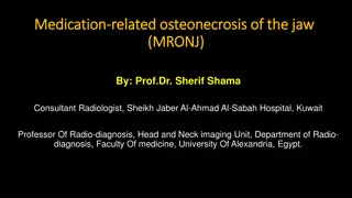 Understanding Medication-Related Osteonecrosis of the Jaw (MRONJ) in Cancer Patients