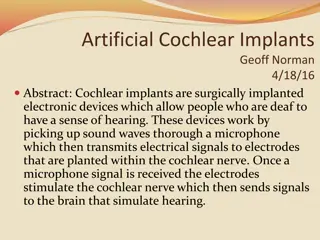 Understanding Cochlear Implants: History, Mechanisms, and Functionality