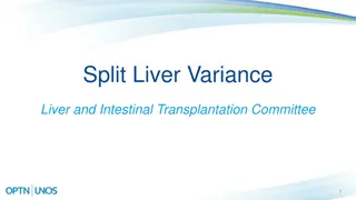 Innovative Proposal for Split Liver Transplantation Variance