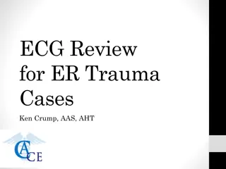 Understanding ECG: Electrocardiogram Basics for ER Trauma Cases