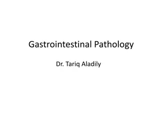 Understanding Esophageal Diseases: Symptoms and Treatment Overview