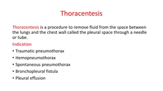 Thoracentesis Procedure: Indications, Contraindications, Risks, and Precautions