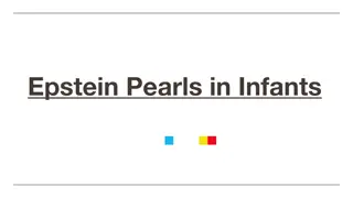 Epstein Pearls in Infants