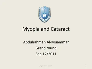 Understanding Myopia and Cataract: Prevalence, Risk Factors, and Consequences