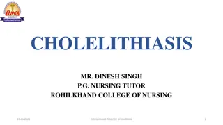 Understanding Cholelithiasis: Causes, Symptoms, and Management