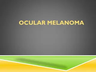 Understanding Ocular Melanoma: Symptoms, Diagnosis & Treatment