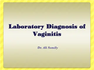 Understanding Vaginitis: Symptoms, Causes, and Diagnosis