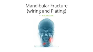Orthodontic Wiring Techniques for Mandibular Fracture Treatment